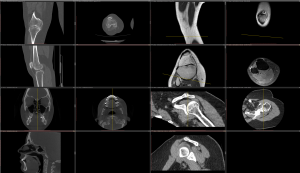 Type d'imageries traitées par nos équipes: CT, IRM, CBCT, Arthroscanner